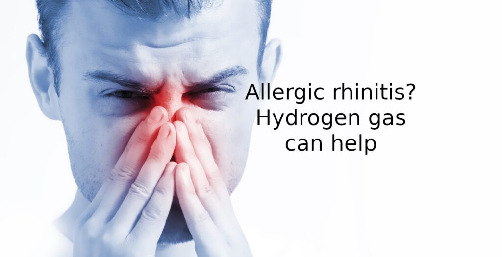 Allergic rhinitis